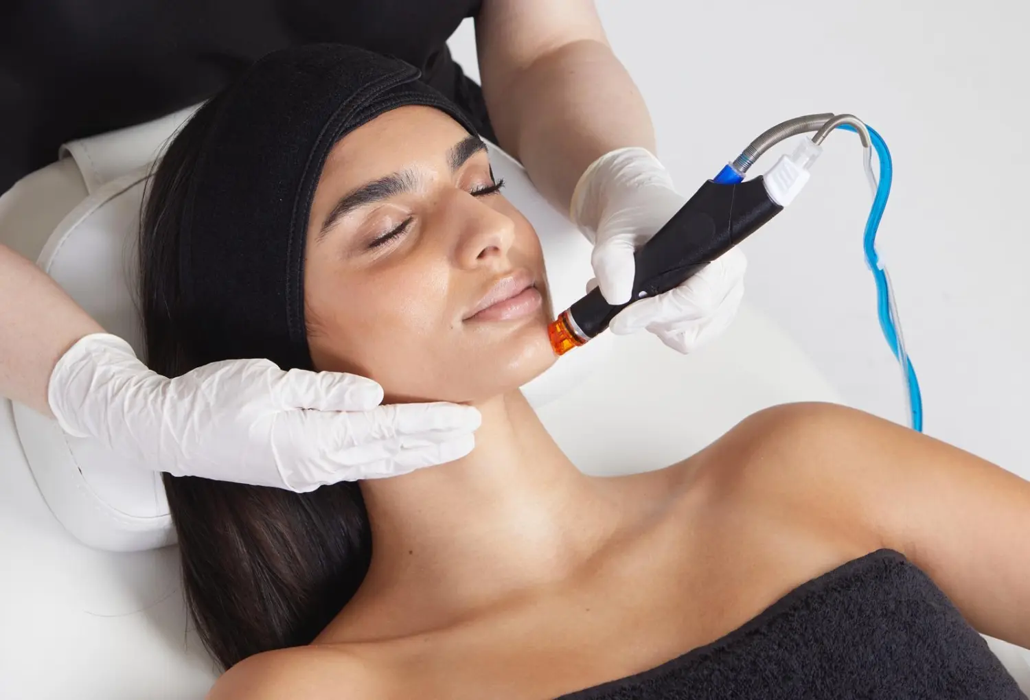 HydraFacial , Kosmetik Murnau, Cosmetics, Apparative Cosmetics , facial treatment, Jet Peel, Microneedling , Hydra Facial, Medical Beauty